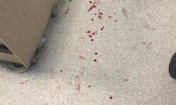 Suruç Devlet Hastanesinde Sekreteri Zımba İle Dövdüler!