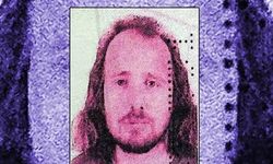 Saç ektirip, dişlerini yaptıran İngilizin ölümüne soruşturma