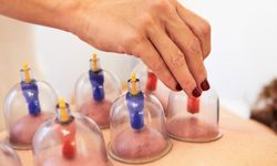 Hacamat Nedir? Neye İyi Gelir?Hacamat Nedir? Neye İyi Gelir?