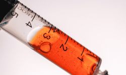 Morton Nöroma Kortizon İğnesi Tedavisi: Ağrısız Adımlara Geri Dönüş