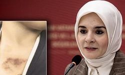 Kreşte taciz ve şiddet skandalı: 'Benzer vakalar olduğu bilinmekte'