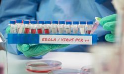 Kongo Demokratik Cumhuriyeti'nde Ebola bilançosu ağırlaştı: Can kaybı 4 bin 178'e ulaştı
