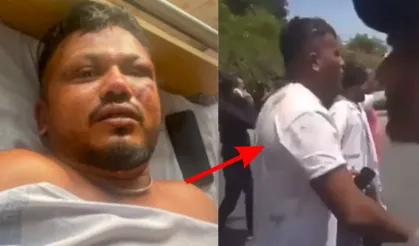 Parçalanan uçaktan yürüyerek çıkmıştı! Nasıl sağ kurtulduğunu anlattı! 11A'nın sırrı..