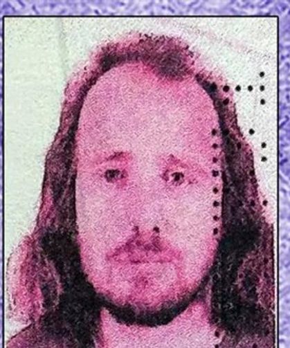 Saç ektirip, dişlerini yaptıran İngilizin ölümüne soruşturma