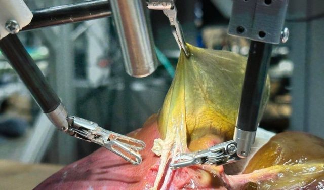 Robot cerrah sıfır hata ile ameliyat yaptı, tüm kararları kendi aldı