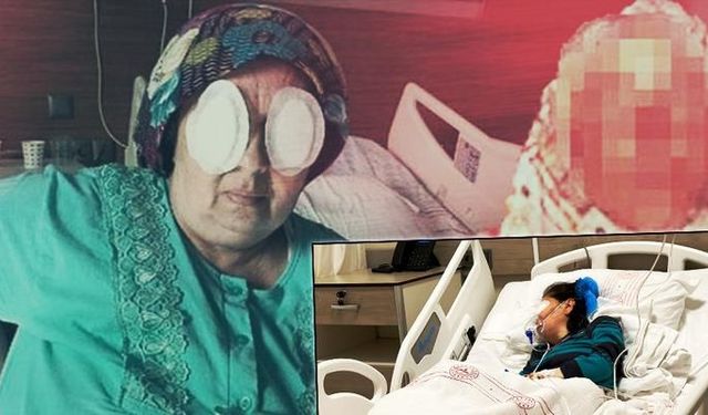 Şizofreni hastası kadın bakımevinde dehşet saçtı!