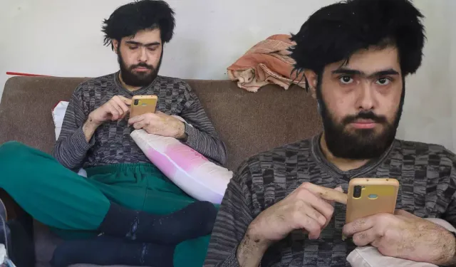 3 yıldır tırnaklarını kesmeyen ve duş almayan gencin eski hali ortaya çıktı