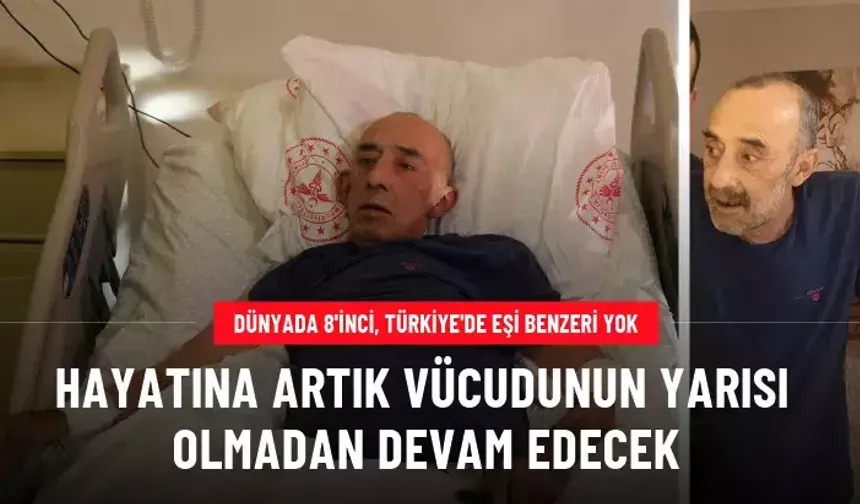 Hayatına artık vücudunun yarısı olmadan devam edecek