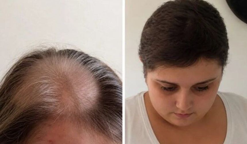 İngiltere'de 11 Yıllık Tıp Skandalı: 'Beyin Tümörü Var' Denilen Kadın Hiç Kanser Olmadığını Öğrendi